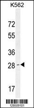 OR52D1 Antibody (C-term)