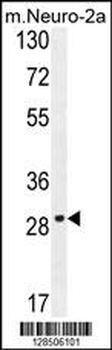 OR9Q1 Antibody (C-term)