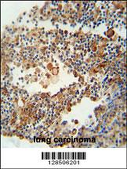 OR9Q1 Antibody (C-term)