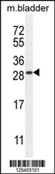 TIFAB Antibody (Center)