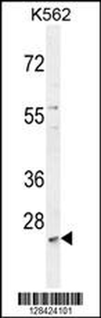 MCART2 Antibody (N-term)