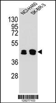 KRT80 Antibody (C-term)