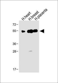 ENT1 Antibody (C-term)