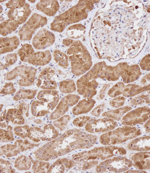 WDR41 Antibody (C-term)