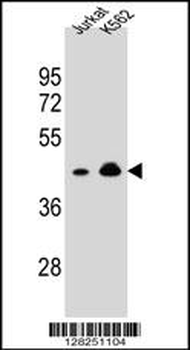OR10A4 Antibody (C-term)