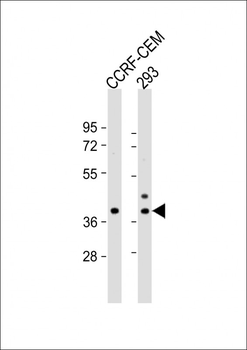 CCDC122 Antibody (C-term)