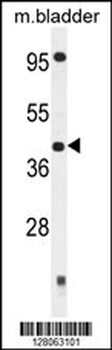 SLFNL1 Antibody (N-term)