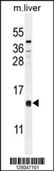 CCDC126 Antibody (C-term)
