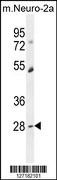 DPCD Antibody (Center)