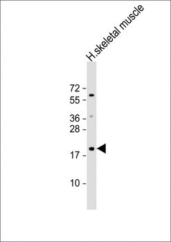 IMMP1L Antibody (C-term)