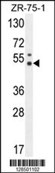 PUS3 Antibody (N-term)