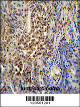 PUS3 Antibody (N-term)