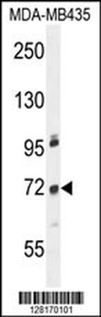 ZNF510 Antibody (N-term)