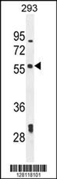 LARP6 Antibody (N-term)