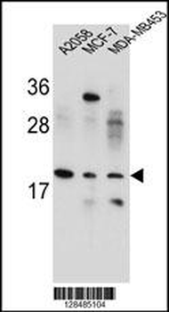 VCX1 Antibody (N-term)