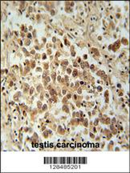 VCX1 Antibody (N-term)