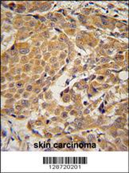 AWAT2 Antibody (C-term)