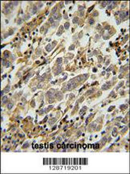 ASB17 Antibody (C-term)