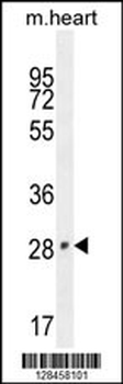 VGLL2 Antibody (N-term)