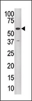 KAT5 / Tip60/HTATIP Antibody (C-term)