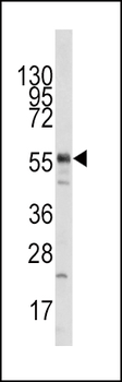 KAT5 / Tip60/HTATIP Antibody (N-term)
