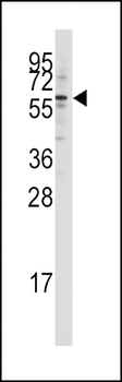 KAT5 / Tip60/HTATIP Antibody (N-term)