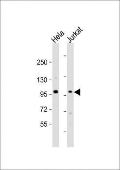 NSUN2 Antibody (Center)