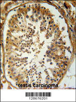 SRAC1 Antibody (C-term)