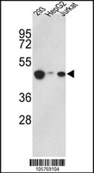 KAT1 (HAT1) Antibody (C-term)