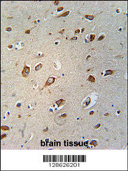 CB086 Antibody (C-term)