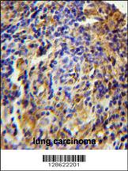 CK073 Antibody (N-term)