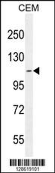 AT8B2 Antibody (N-term)