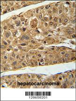 RT4I1 Antibody (C-term)