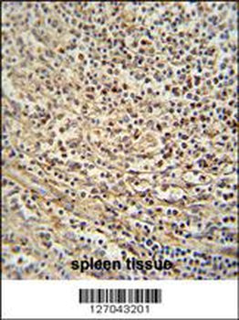 GSDMC Antibody (Center)