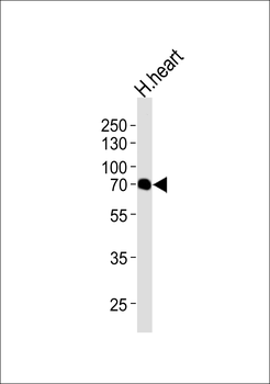CLPX Antibody (C-term)