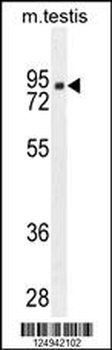 CLPX Antibody (C-term)