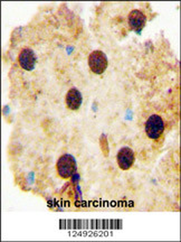 OAZ2 Antibody (C-term)