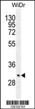ZC4H2 Antibody (C-term)