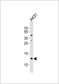 SPRR2A Antibody (C-term)