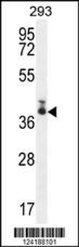 TMEM66 Antibody (N-term)
