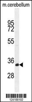 TMEM66 Antibody (N-term)