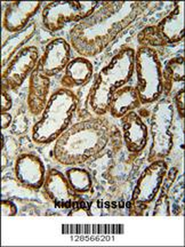 NDUFC2 Antibody (C-term)