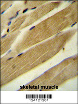 RPH3AL Antibody (C-term)