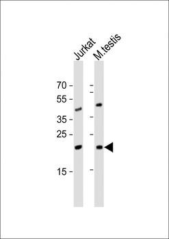 ORMDL3 Antibody (Center)