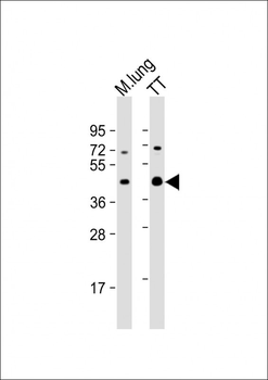 NKX2-1 Antibody (N-term)