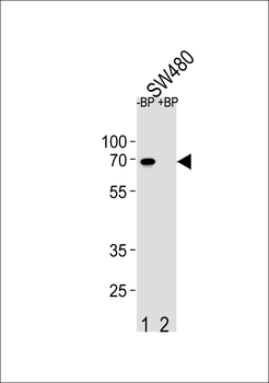 ETV5 Antibody (N-term)