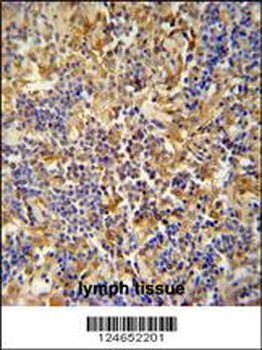 IBTK Antibody (Center)
