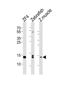 HIST1H2BJ Antibody (Center)