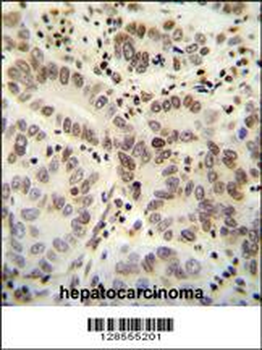 HIST1H2BJ Antibody (Center)