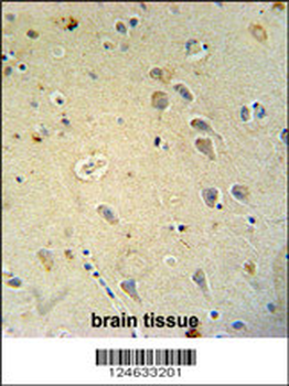 GRIA4 Antibody (Center)